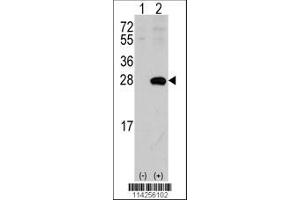 Image no. 1 for anti-sigma Non-Opioid Intracellular Receptor 1 (SIGMAR1) (AA 47-81), (N-Term) antibody (ABIN389221)