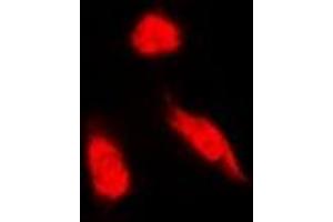 Image no. 1 for anti-NCK Adaptor Protein 1 (NCK1) (full length) antibody (ABIN6043714)