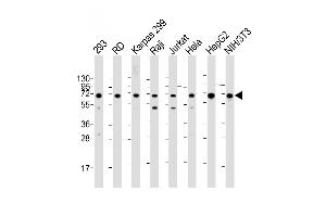 IGF2BP1 Antikörper  (C-Term)