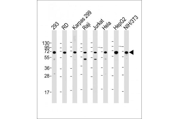 IGF2BP1 anticorps  (C-Term)