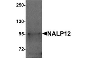 Image no. 1 for anti-NLR Family, Pyrin Domain Containing 12 (NLRP12) (N-Term) antibody (ABIN783719)