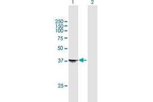 Image no. 1 for anti-Syntaxin 18 (STX18) (AA 1-335) antibody (ABIN526972)