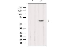 Image no. 1 for anti-Catalase (CAT) antibody (ABIN6260491)