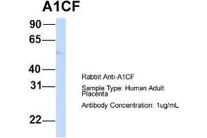 Image no. 2 for anti-APOBEC1 Complementation Factor (A1CF) (N-Term) antibody (ABIN2776627)
