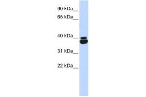 Image no. 1 for anti-Orthopedia Homeobox (OTP) (N-Term) antibody (ABIN2775923)