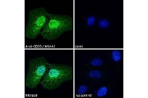 Image no. 6 for anti-Membrane-Spanning 4-Domains, Subfamily A, Member 1 (MS4A1) (C-Term) antibody (ABIN570905)