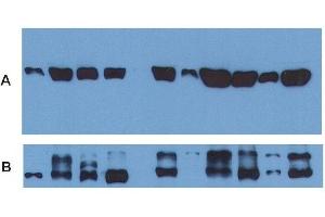 Image no. 6 for anti-alpha Tubulin (TUBA1) antibody (ABIN93891)