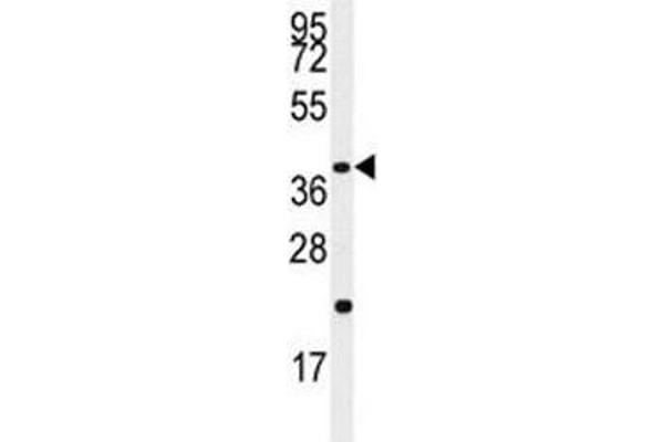 anti-Caspase 9, Apoptosis-Related Cysteine Peptidase (CASP9) (Ser196) antibody
