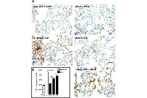 Image no. 4 for anti-Transforming Growth Factor, beta 1 (TGFB1) antibody (ABIN107740)