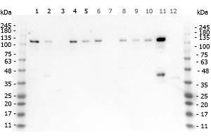 Image no. 3 for anti-Histone Deacetylase 5 (HDAC5) (Internal Region) antibody (ABIN1607888)