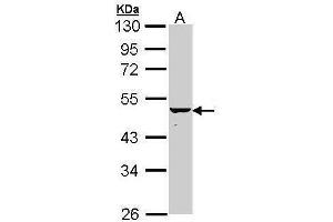 Keratin 34 anticorps  (Center)