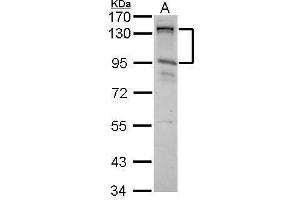 Image no. 1 for anti-CDKN1A Interacting Zinc Finger Protein 1 (CIZ1) (Internal Region) antibody (ABIN2855299)