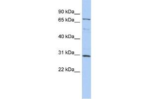Image no. 1 for anti-Cyclin D Binding Myb-Like Transcription Factor 1 (DMTF1) (N-Term) antibody (ABIN2775904)