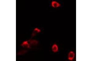 Image no. 2 for anti-TAF5-Like RNA Polymerase II, P300/CBP-Associated Factor (PCAF)-Associated Factor, 65kDa (TAF5L) antibody (ABIN6258336)
