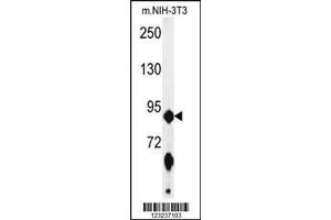 Image no. 2 for anti-ATP-Binding Cassette, Sub-Family F (GCN20), Member 1 (ABCF1) (AA 687-716), (C-Term) antibody (ABIN653226)