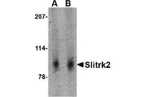 Image no. 1 for anti-SLIT and NTRK-Like Family, Member 2 (SLITRK2) (Middle Region) antibody (ABIN1031099)