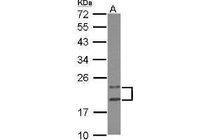 Image no. 3 for anti-PYD and CARD Domain Containing (PYCARD) (Center) antibody (ABIN2855403)