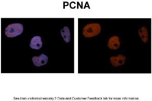 Image no. 3 for anti-Proliferating Cell Nuclear Antigen (PCNA) (C-Term) antibody (ABIN2792157)