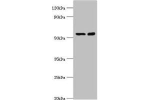 STK3 anticorps  (AA 323-450)