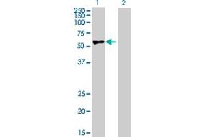 Western Blot analysis of ROD1 expression in transfected 293T cell line by ROD1 MaxPab polyclonal antibody.