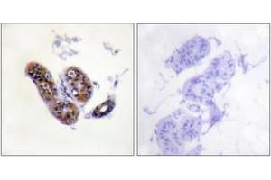 Image no. 3 for anti-Microphthalmia-Associated Transcription Factor (MITF) (AA 151-200) antibody (ABIN1532362)