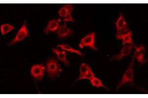 Image no. 2 for anti-Glyceronephosphate O-Acyltransferase (GNPAT) antibody (ABIN6258220)