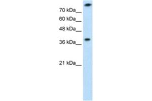 Image no. 1 for anti-Thiosulfate Sulfurtransferase (Rhodanese) (TST) antibody (ABIN2462532)