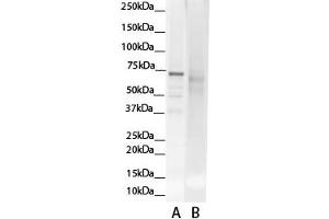 Image no. 2 for anti-Glutamate-Cysteine Ligase, Catalytic Subunit (GCLC) (N-Term) antibody (ABIN2774078)