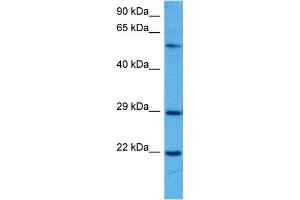 Image no. 5 for anti-Suppressor of Cytokine Signaling 1 (SOCS1) (N-Term) antibody (ABIN2777164)