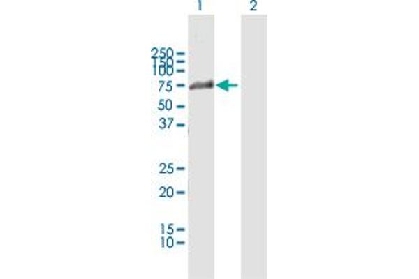 anti-Zinc Finger Protein 18 (ZNF18) (AA 1-549) antibody
