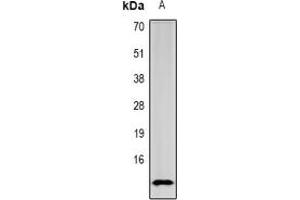 Image no. 2 for anti-serine Peptidase Inhibitor, Kazal Type 1 (SPINK1) (full length) antibody (ABIN6006128)