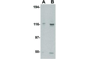 Image no. 2 for anti-Kinesin Family Member 5A (KIF5A) (C-Term) antibody (ABIN6656247)