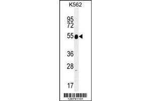 Image no. 1 for anti-Keratin 25 (KRT25) (AA 380-408), (C-Term) antibody (ABIN655199)