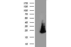Image no. 1 for anti-Family With Sequence Similarity 119A (FAM119A) antibody (ABIN2720741)