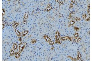 Image no. 2 for anti-Lysophosphatidylcholine Acyltransferase 1 (LPCAT1) (Internal Region) antibody (ABIN6262997)