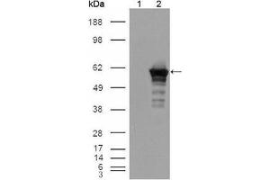 Image no. 2 for anti-Desmin (DES) antibody (ABIN969477)