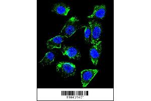 Image no. 1 for anti-Betacellulin (BTC) (AA 17-45), (N-Term) antibody (ABIN655615)