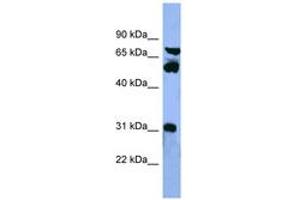 Image no. 1 for anti-Cytochrome P450, Family 8, Subfamily B, Polypeptide 1 (CYP8B1) (AA 219-268) antibody (ABIN6746764)