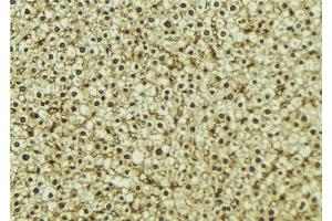Image no. 2 for anti-PHD Finger Protein 17 (PHF17) (C-Term) antibody (ABIN6264173)