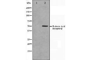 Image no. 3 for anti-Retinoic Acid Receptor, beta (RARB) (Internal Region) antibody (ABIN6264705)