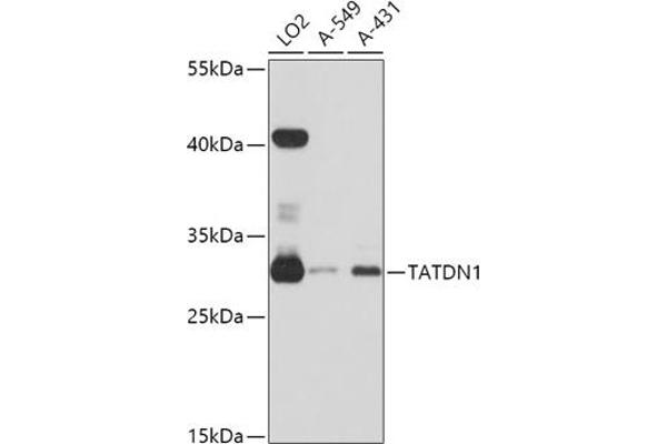 TATDN1 抗体  (AA 1-297)