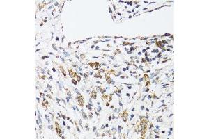 Image no. 2 for anti-Dehydrogenase/reductase (SDR Family) Member 2 (DHRS2) antibody (ABIN6139594)
