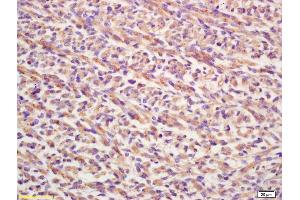 Image no. 1 for anti-Fibroblast Growth Factor 8 (Androgen-Induced) (FGF8) (AA 131-233) antibody (ABIN672516)