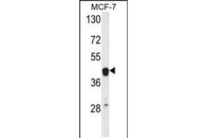 Image no. 1 for anti-V-Ets Erythroblastosis Virus E26 Oncogene Homolog 2 (ETS2) (AA 146-173) antibody (ABIN5538586)