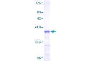 Numb Homolog (NUMB) (AA 1-135) protein (GST tag)