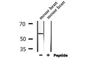 Image no. 4 for anti-WAS Protein Family, Member 3 (WASF3) (Internal Region) antibody (ABIN6257552)
