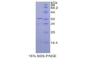 Image no. 1 for Protein Disulfide Isomerase Family A, Member 6 (PDIA6) (AA 20-440) protein (His tag) (ABIN1877889)