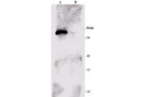 anti-Ribosomal Protein S6 Kinase, 90kDa, Polypeptide 1 (RPS6KA1) (C-Term) antibody (Biotin)