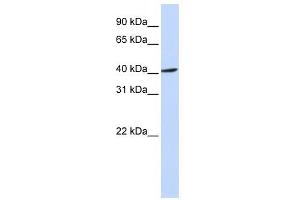 Image no. 1 for anti-F-Box Protein 28 (FBXO28) (Middle Region) antibody (ABIN631726)