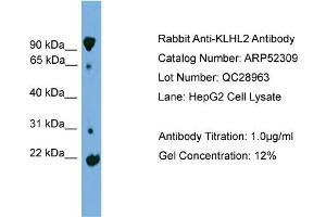 Image no. 2 for anti-Kelch-Like 2, Mayven (KLHL2) (Middle Region) antibody (ABIN2784875)